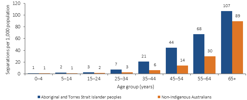 Figure 1.05-4 shows age-specific hospitalisation rates for circulatory disease (rate per 1,000 population) in July 2013-June 2015, by Indigenous status. Data are presented for Aboriginal and Torres Strait Islander peoples and non-Indigenous Australians. The age groups presented are: 0-4 years; 5-14 years; 15-24 years; 24-34 years; 35-44 years; 45-54 years; 55-64 years; and 65 years and over. Indigenous Australians had higher rates of hospitalisation for circulatory disease across all age-groups compared to non-Indigenous Australians.