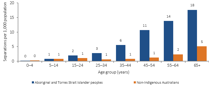 Figure 1.09-4 shows age-specific hospitalisation rates for a principal diagnosis of diabetes (rate per 1,000 population) in July 2013-June 2015, by Indigenous status and age. Data are presented for Aboriginal and Torres Strait Islander peoples and non-Indigenous Australians. The age groups presented are: 0-4 years; 5-14 years; 15-24 years; 25-34 years; 35-44 years; 45-54 years; 55-64 years; and 65 years and over. In the two years to June 2015, the Indigenous hospitalisation rate for diabetes was 4.2 times the non-Indigenous rate, with the gap increasing with age.