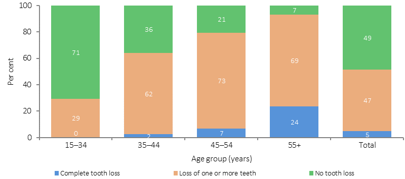 Figure 1.11-1 shows the status of tooth loss (complete tooth loss, loss of one or more teeth, and no tooth loss) for Aboriginal and Torres Strait Islander peoples in the period 2012-13, by age.  Data are presented for the following age groups:  15-34, 35-44, 45-54, and 55 and over, as well as a total. As expected, the figure shows that the extent of tooth loss increases with age. 
